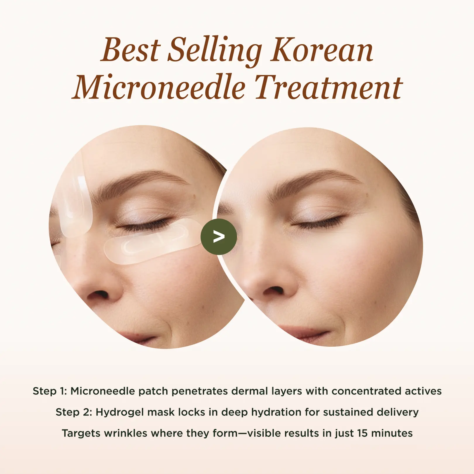 Advanced K-Beauty Microneedle Combo Mask - Image 3