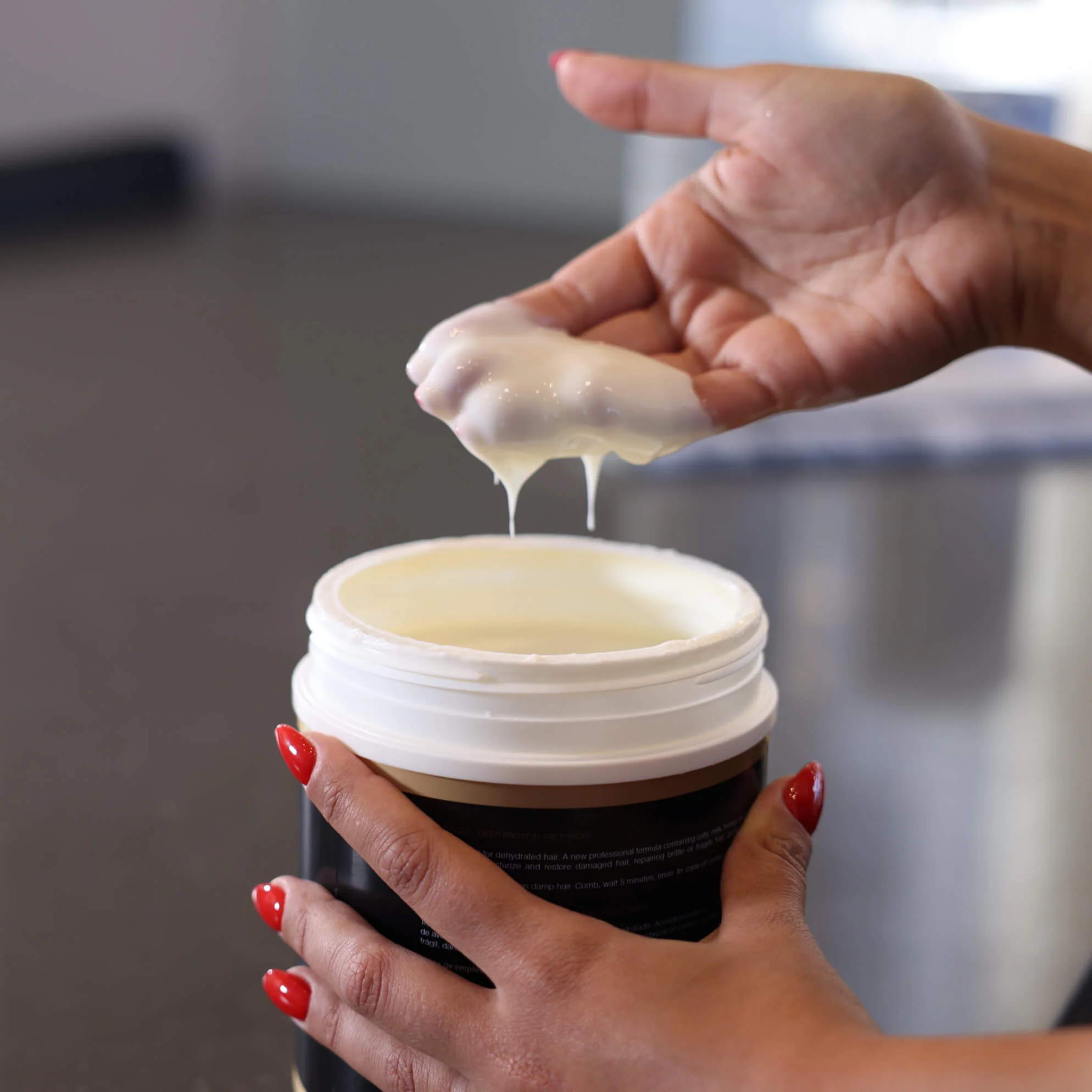 Harmonize Bonding Treatment | 2 Month - Image 6