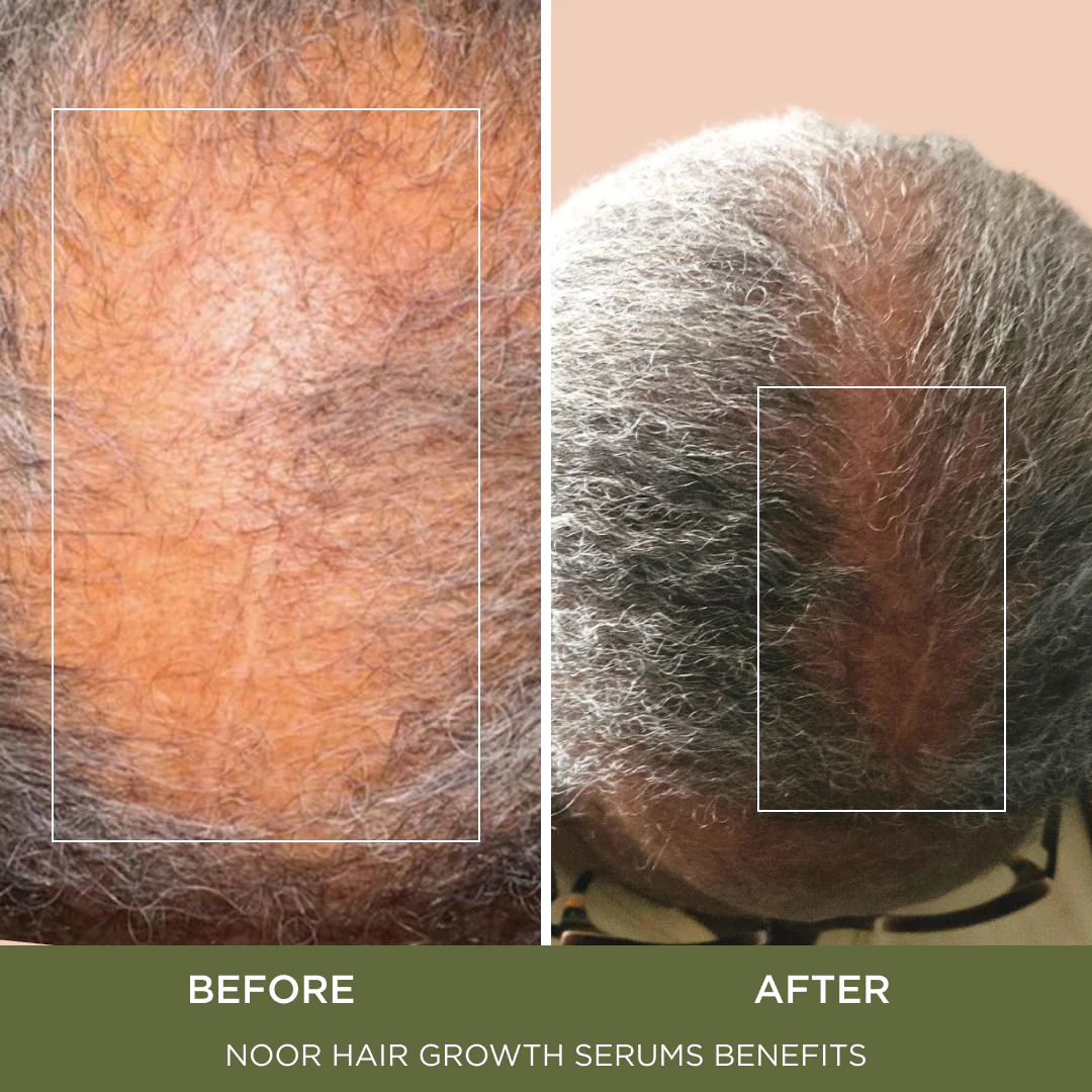 Love Hair Serum - Image 4