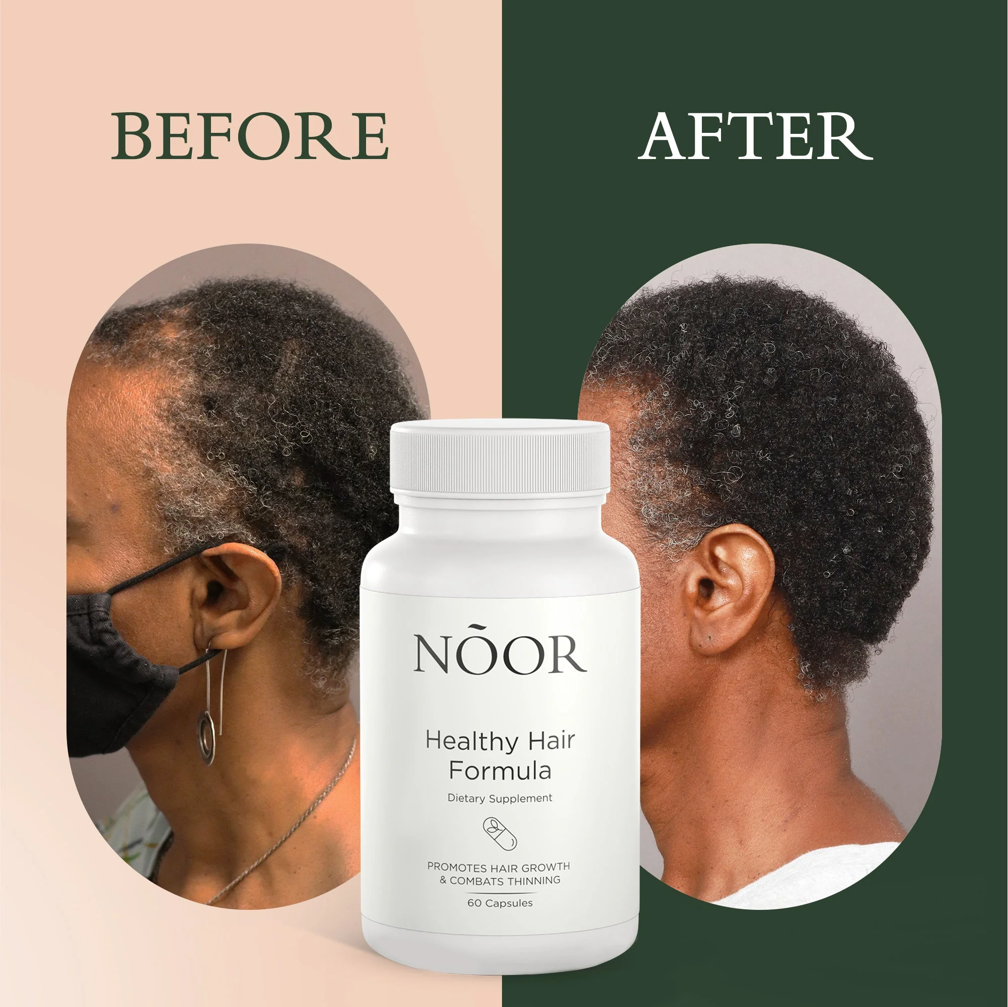 Menobalance Bundle - Image 12