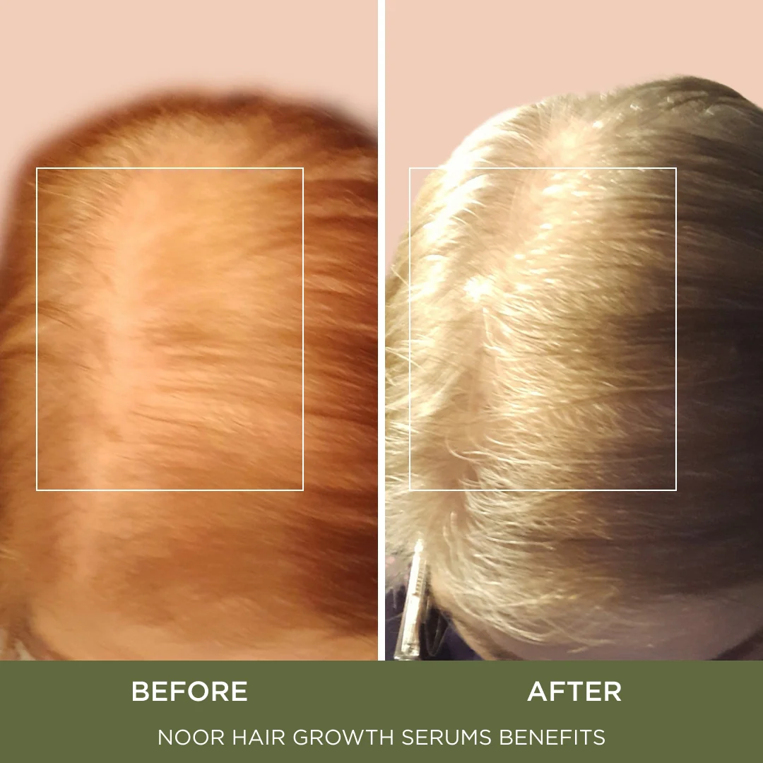 Super Hair Serum - Image 4