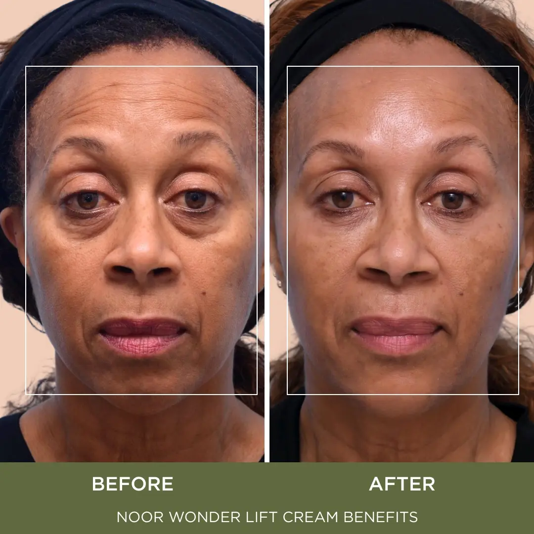 WonderLift Cream Lower - Image 4